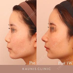 KAUNIS CLINIC（カウニスクリニック） 高野 敏郎医師の症例