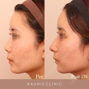 KAUNIS CLINIC（カウニスクリニック） 高野 敏郎医師の症例