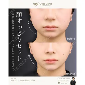 Otus Clinic 【オータスクリニック】 中 徳太郎医師の症例