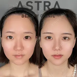 ASTRA BEAUTY CLINICの症例