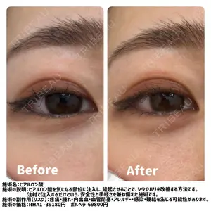 湘南美容クリニック 銀座院の症例