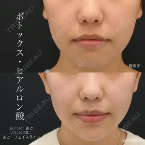 湘南美容クリニック 銀座院の症例