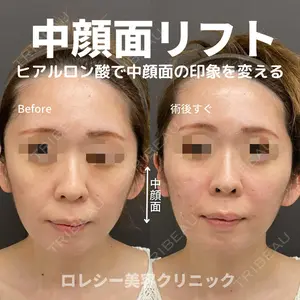 ロレシー美容クリニック 心斎橋駅前院 福留院長医師の症例