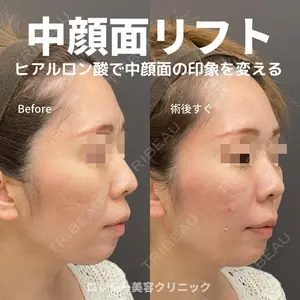 ロレシー美容クリニック 心斎橋駅前院 福留院長医師の症例