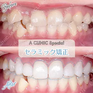 東京銀座A CLINIC デンタルの症例