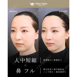 Otus Clinic 【オータスクリニック】 中 徳太郎医師の症例