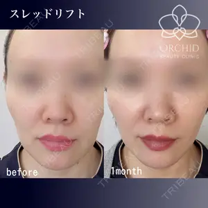 オーキッド美容クリニック東京御徒町 西浦 蘭子医師の症例