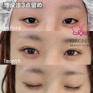 オーキッド美容クリニック東京御徒町 西浦 蘭子医師の症例