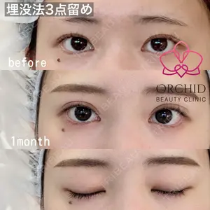 オーキッド美容クリニック東京御徒町 西浦 蘭子医師の症例