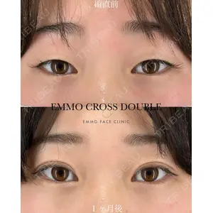 EMMO FACE CLINIC 大宮院 廣松 直樹医師の症例