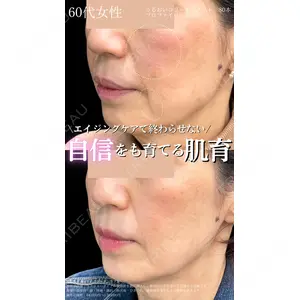 湘南美容クリニック 大阪梅田院の症例