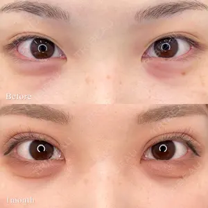東京シンデレラ美容外科 池袋院の症例