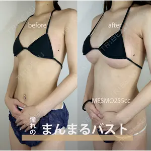 GAYA body design clinic 飯ヶ谷 重来医師の症例