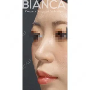 BIANCA銀座 堀田 和亮医師の症例