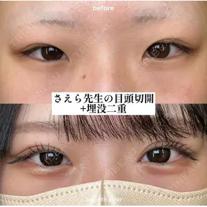 EMMO FACE CLINIC 大阪梅田院 山﨑 冴羅医師の症例