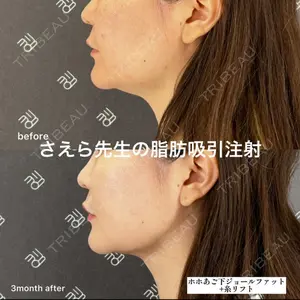 EMMO FACE CLINIC 大阪梅田院 山﨑 冴羅医師の症例