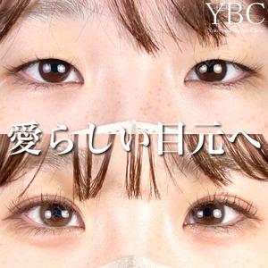 YBC横浜美容外科 池袋院 磯村 亮輔医師の症例