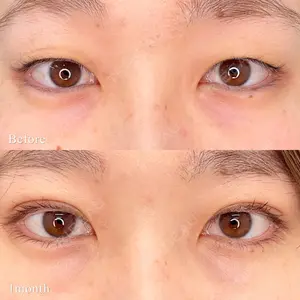 東京シンデレラ美容外科 池袋院の症例