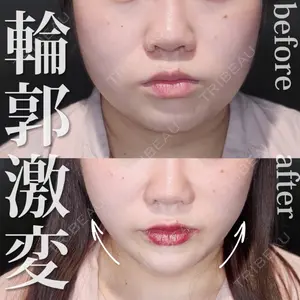 Tokyo Tensei Clinic 新宿院の症例