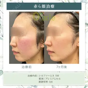 オラクル美容皮膚科 東京新宿院の症例