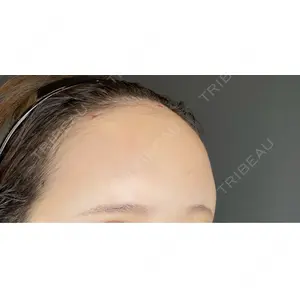ルラ美容クリニック 広島院の症例