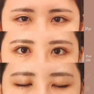 KAUNIS CLINIC（カウニスクリニック） 高野 敏郎医師の症例