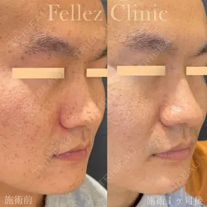 Fellez Clinic【フェルズクリニック】 小野 泰寛医師の症例