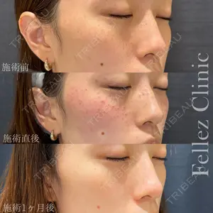 Fellez Clinic【フェルズクリニック】 小野 泰寛医師の症例