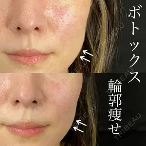藤・ナチュレ美容クリニック 銀座院の症例