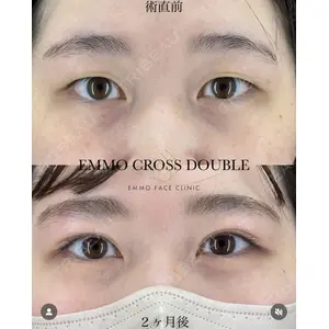 EMMO FACE CLINIC 大宮院 廣松 直樹医師の症例