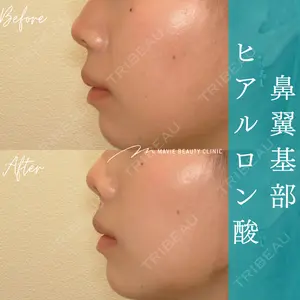 Mavie Beauty Clinic （マヴィービューティークリニック） 渡邉 憲一郎医師の症例