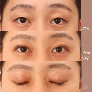 KAUNIS CLINIC（カウニスクリニック） 高野 敏郎医師の症例