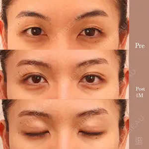 KAUNIS CLINIC（カウニスクリニック） 高野 敏郎医師の症例