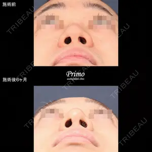 プリモ麻布十番クリニック 大場教弘医師の症例