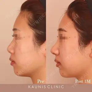 KAUNIS CLINIC（カウニスクリニック） 高野 敏郎医師の症例