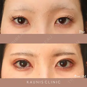 KAUNIS CLINIC（カウニスクリニック） 高野 敏郎医師の症例