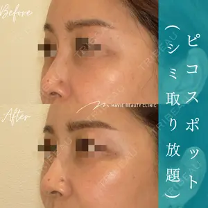 Mavie Beauty Clinic （マヴィービューティークリニック）の症例