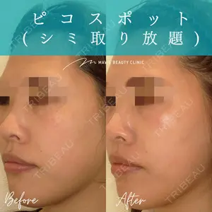 Mavie Beauty Clinic （マヴィービューティークリニック） 榎本　さやか医師の症例