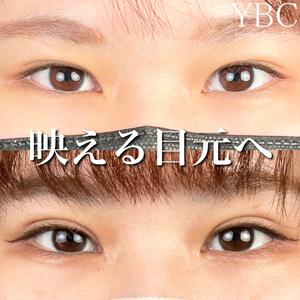 YBC横浜美容外科 池袋院 磯村 亮輔医師の症例