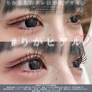 湘南美容クリニック 銀座院の症例