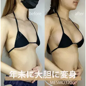 GAYA body design clinic 飯ヶ谷 重来医師の症例