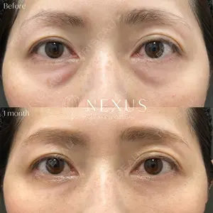 NEXUS CLINICの症例