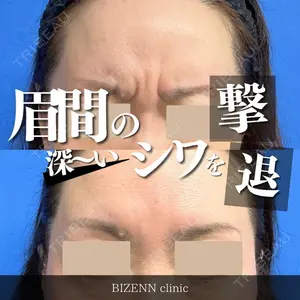 BIZENNクリニック【ビゼンクリニック】の症例