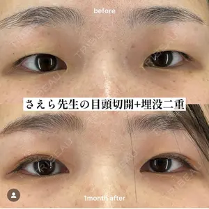 EMMO FACE CLINIC 大阪梅田院 山﨑 冴羅医師の症例