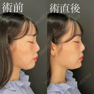 HAAB×DREAM BEAUTY CLINIC 大阪梅田院 柏木 太雅医師の症例
