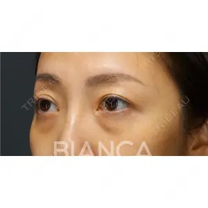 BIANCA銀座 堀田 和亮医師の症例
