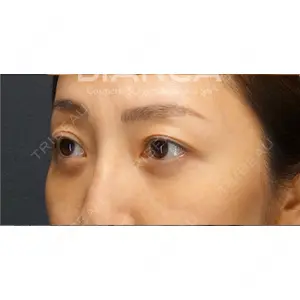 BIANCA銀座 堀田 和亮医師の症例