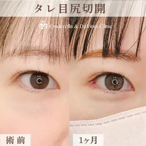 シンデレラ＆ダヴィンチクリニック 宮田 洋佑医師の症例