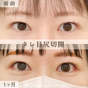 シンデレラ＆ダヴィンチクリニック 宮田 洋佑医師の症例