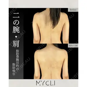 MYCLI【マイクリ】 本田マイケル武史医師の症例
